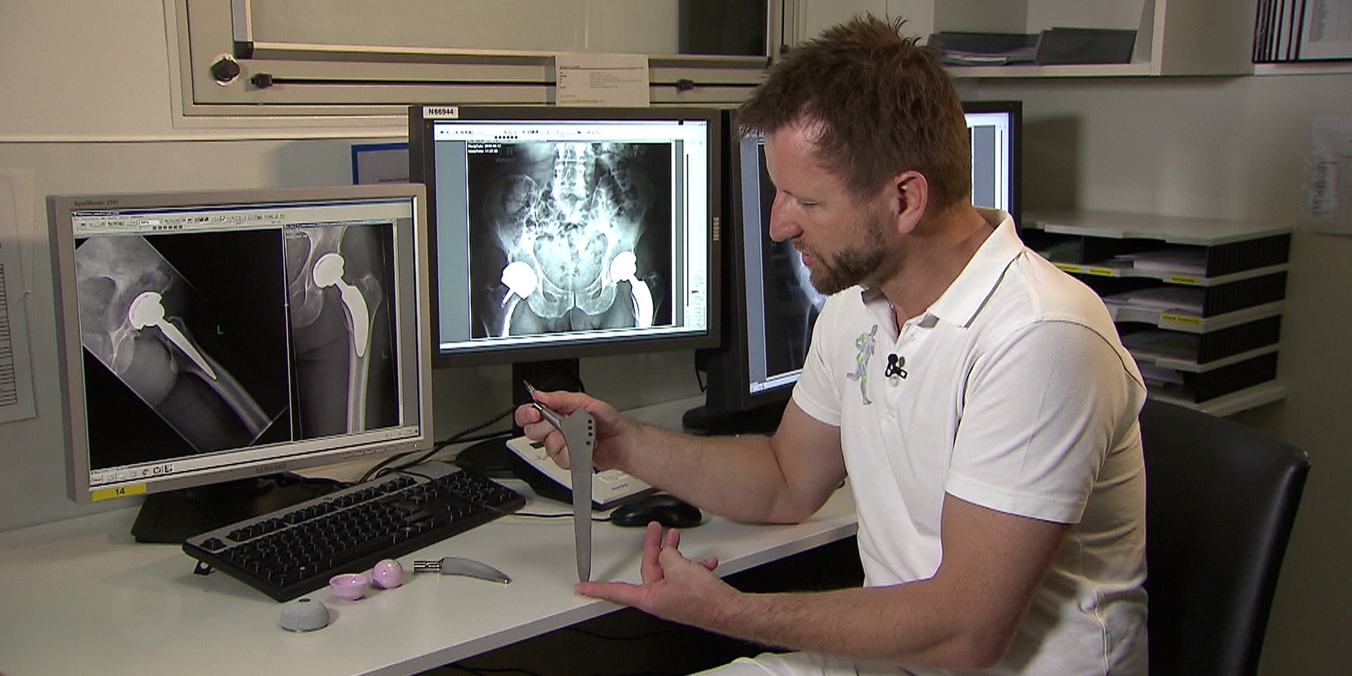 © ORF "bewusst gesund" am 16.9.2017: Passgenau – Hüftgelenksprothesen dank 3D Planung