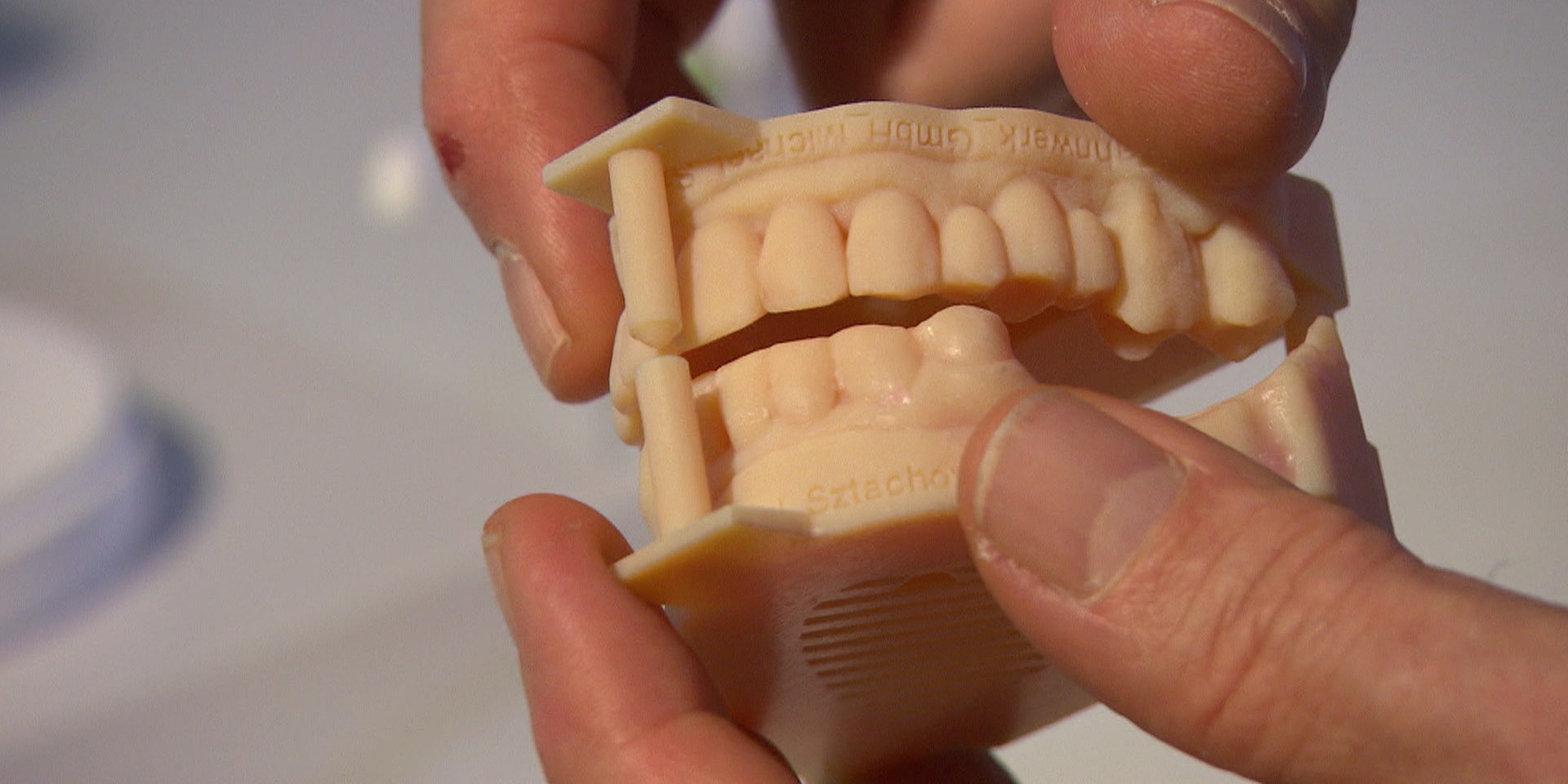© ORF "bewusst gesund" am 27. Jänner 2018: Digitale Zahnmedizin - 3D-Scanner ersetzt Abdruck