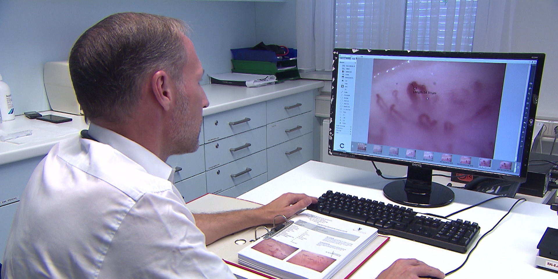 © ORF "bewusst gesund" am 5.1.2019: Einblick - rasche Diagnose bei Rheuma