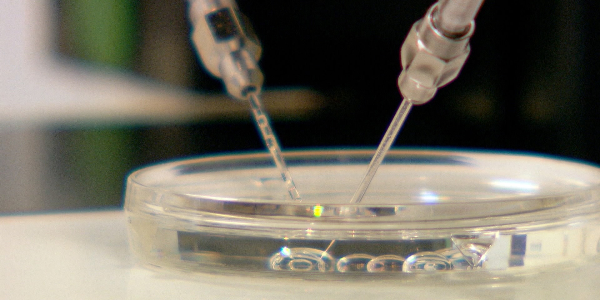 © ORF "bewusst gesund" am 25.5.2019: Künstliche Befruchtung - Hoffen auf Nachwuchs
