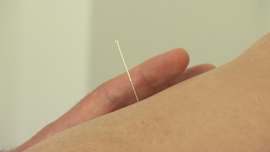 © ORF "bewusst gesund" am 9.1.2021: TCM & Akupunktur – Hilfe bei Adipositas-Operation