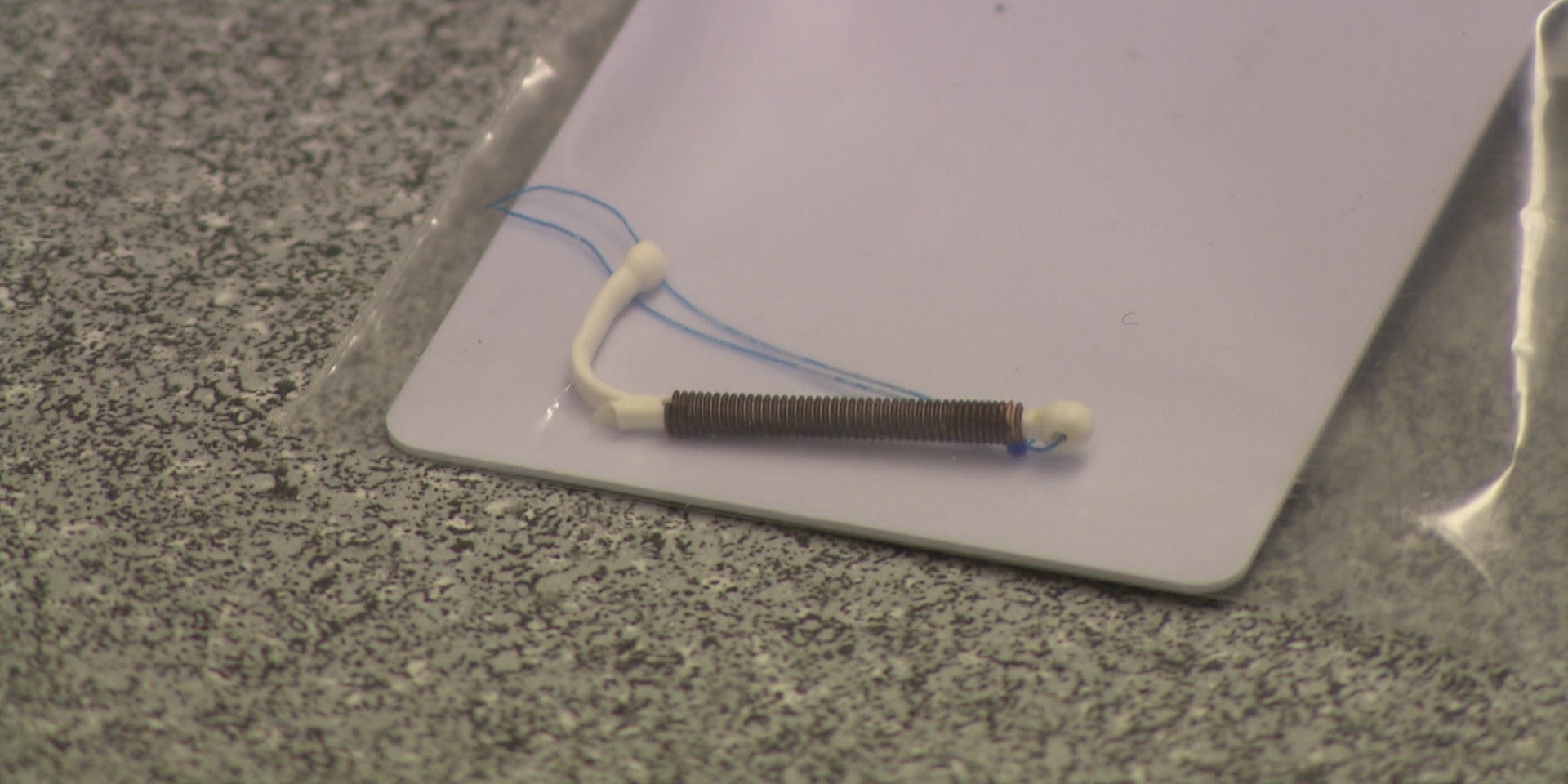 "bewusst gesund" am 27. Februar: Defekte Spirale