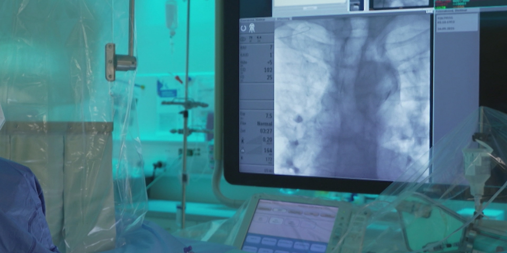 © ORF "bewusst gesund" am 18.12.2021: Angina pectoris - neue Therapie bei Brust-Enge