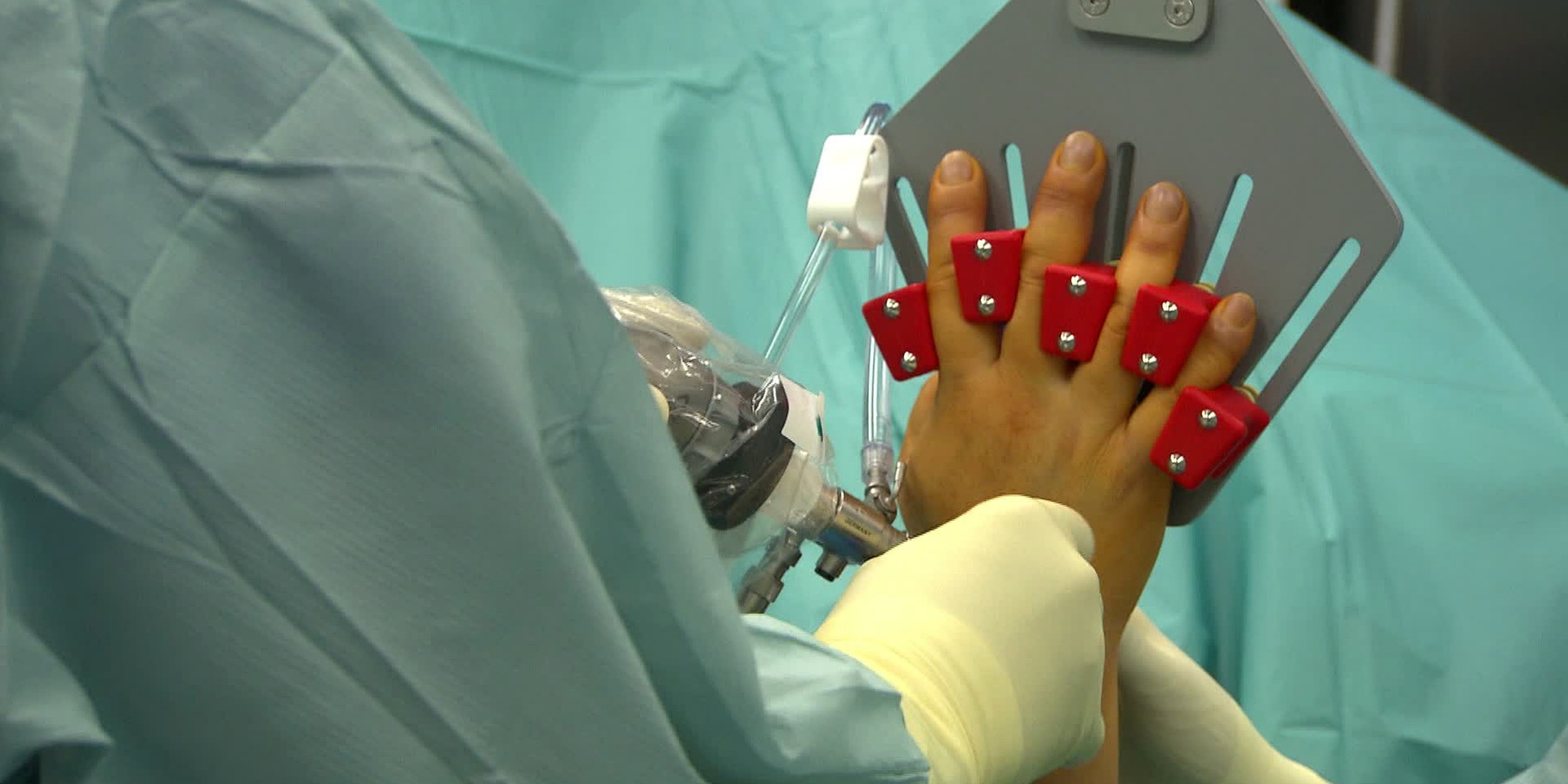 © ORF "bewusst gesund" am 30.3.2024: Arthroskopie - Diagnose und Behandlung in einem