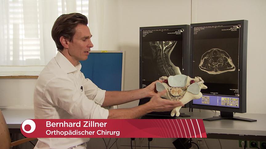 © ORF "bewusst gesund" am 30.3.2024: Beweglich – Künstliche Bandscheibe statt Versteifung