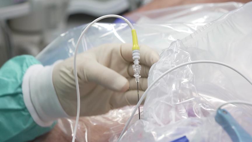 © ORF "Bewusst gesund" am 3.5.2025: Heiße Nadeln: HiTech gegen Trigeminusneuralgie