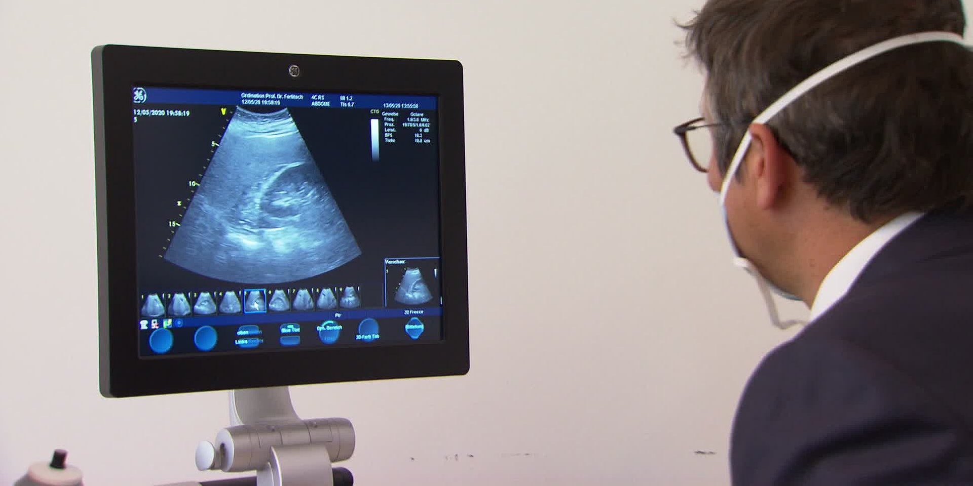 © ORF "bewusst gesund" am 3.9.2022: Stilles Leiden – Fettleber und ihre Folgen